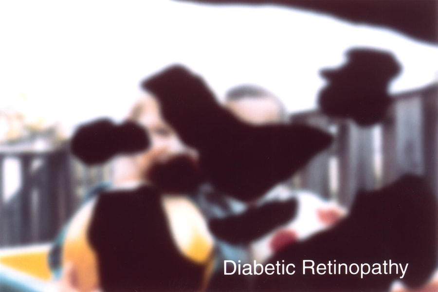 Picture simulating diabetic retinopathy