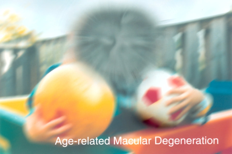 Picture simulating macular degeneration